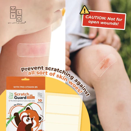 MyLO Scratchguard Relief Patch